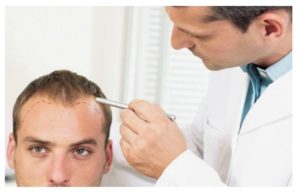 Beneficios del implante de pelo