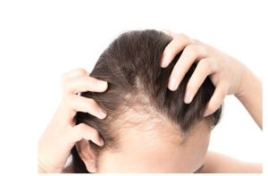 desventajas o contras del implante de cabello