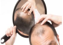 Medicamentos en el postoperatorio de implante de pelo